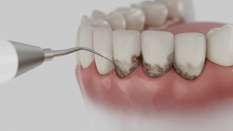 Reliable Wisdom Tooth Removal contractor in San Luis Obispo County County, CA by Dentist Open Now